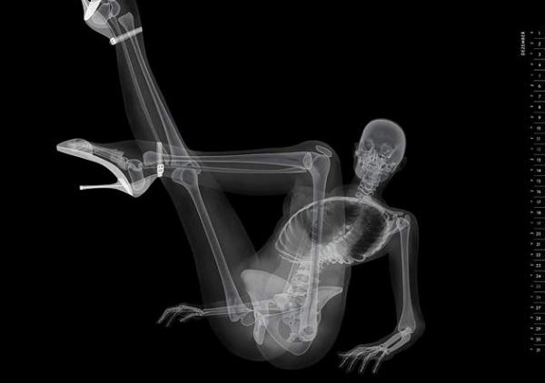 X-ray pinup