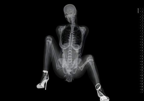 X-ray pinup